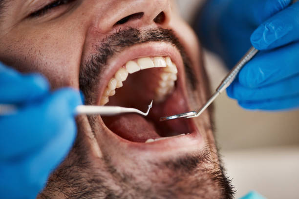 Best Same-Day Emergency Dentist in Rossville, IN