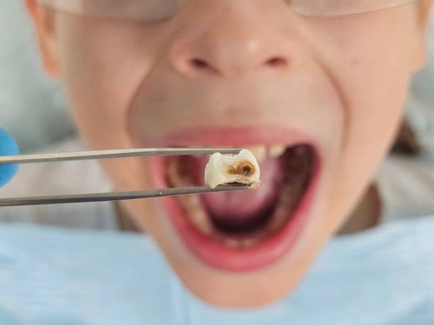 Best Emergency Orthodontic Repairs in Rossville, IN